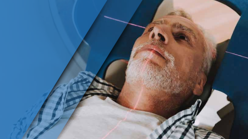 Czy polska radioterapia stanie się bardziej innowacyjna?