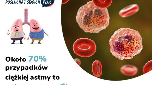 Bezpłatna akcja diagnostyczna dla pacjentów z astmą ciężką w ramach kampanii Posłuchaj Swoich Płuc