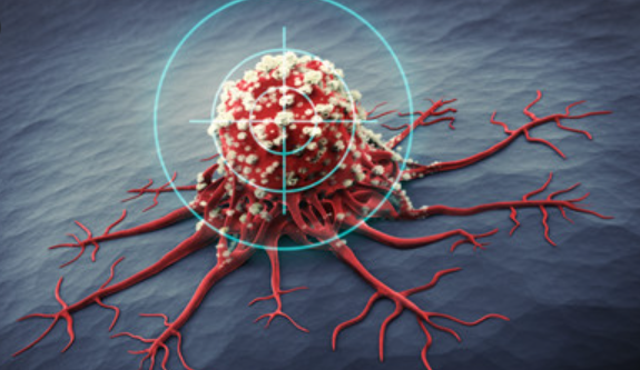 Guzy NET: nowotwory, które udają inne choroby