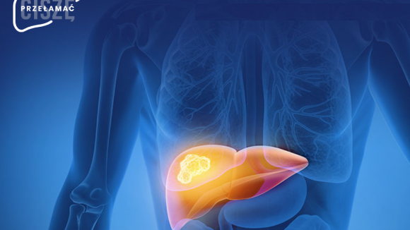 Chorzy na raka wątrobowokomórkowego potrzebują uwagi - startuje kampania edukacyjna „Przełamać ciszę”