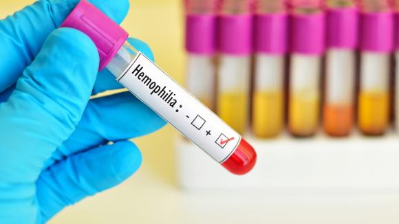 Niezaspokojone potrzeby chorujących na hemofilię. Środowisko pacjentów i ich bliscy apelują o zmiany
