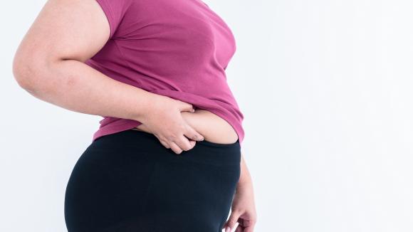 Obalamy 5 najczęstszych mitów na temat otyłości