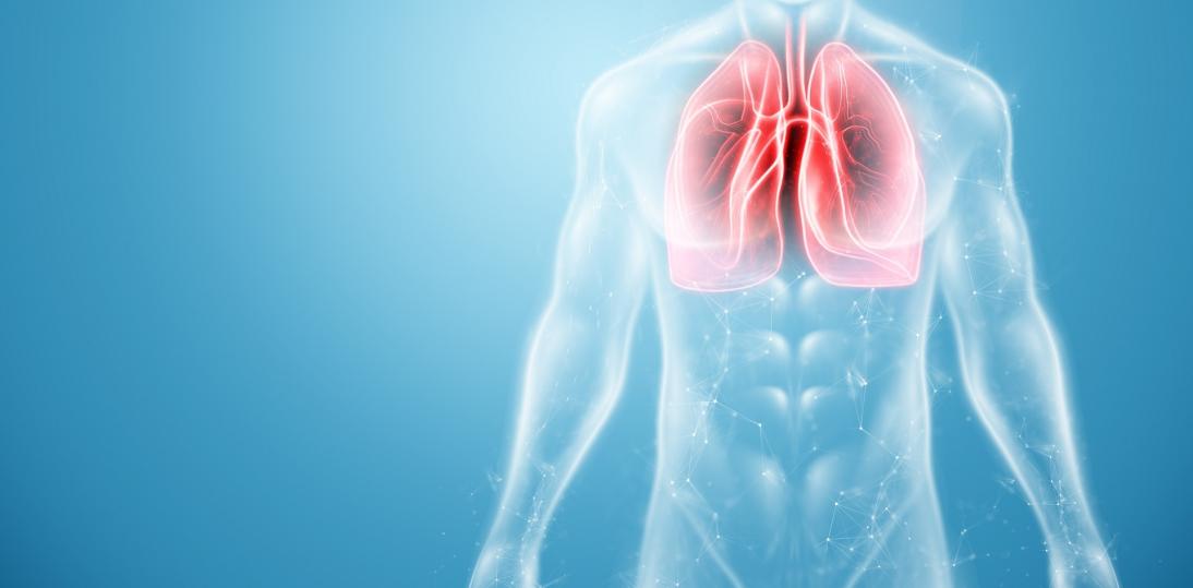 7 na 10 chorych na raka płuca jest leczonych niezgodnie z polskimi i międzynarodowymi wytycznymi - apelują eksperci