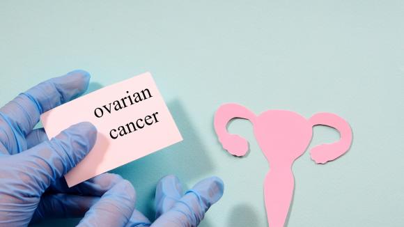 Koniec dyskryminacji genetycznej polskich pacjentek z rakiem jajnika. Od stycznia inhibitory PARP w refundacji bez względu na mutację BRCA1/BRCA2