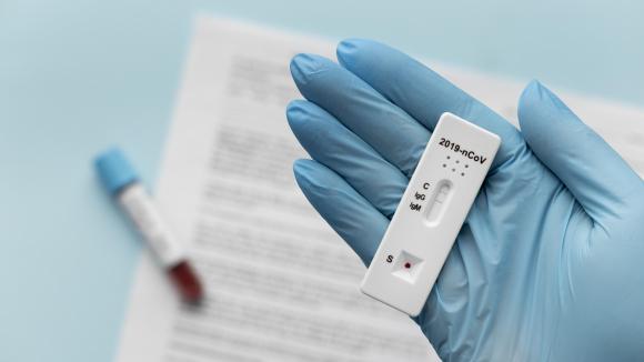 Bezpłatne testy antygenowe tylko w niektórych aptekach