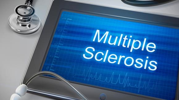 Priorytety w obszarze stwardnienia rozsianego