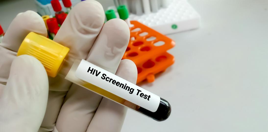 Niewielki odsetek Polaków wykonuje testy w kierunku HIV. Wirus może pozostawać w uśpieniu nawet 10 lat