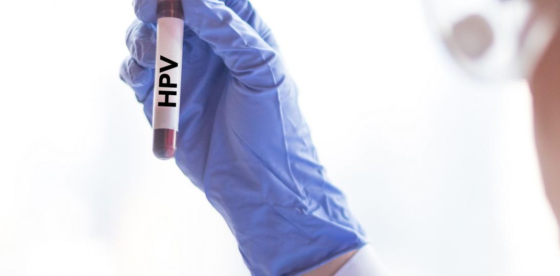 Jak uchronić się przed wirusem HPV i jego konsekwencjami