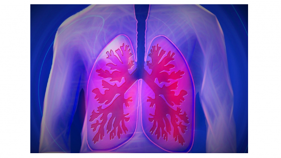 Pacjenci z rakiem płuca - niewidzialni dla systemu?