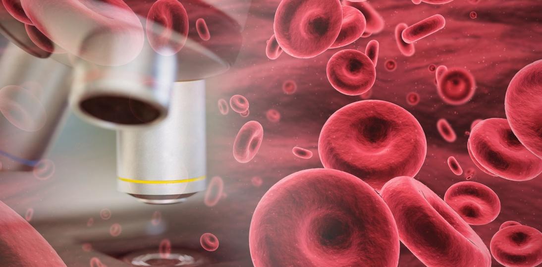Pacjenci hematologiczni żyją coraz dłużej - Wrzesień Światowym Miesiącem Świadomości Nowotworów Krwi