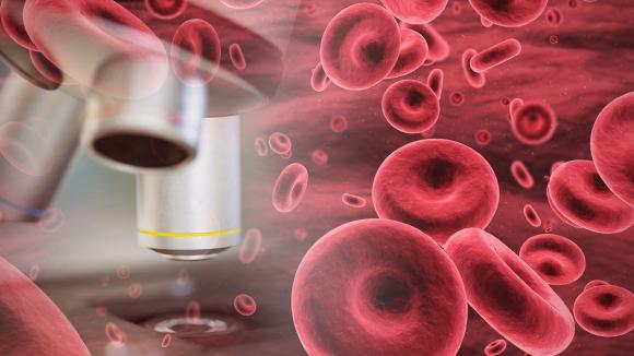 Pacjenci hematologiczni żyją coraz dłużej - Wrzesień Światowym Miesiącem Świadomości Nowotworów Krwi