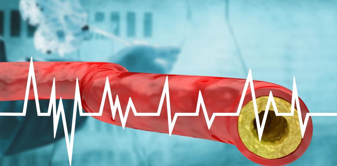 Powstała  światowa „mapa drogowa” do walki z hipercholesterolemią