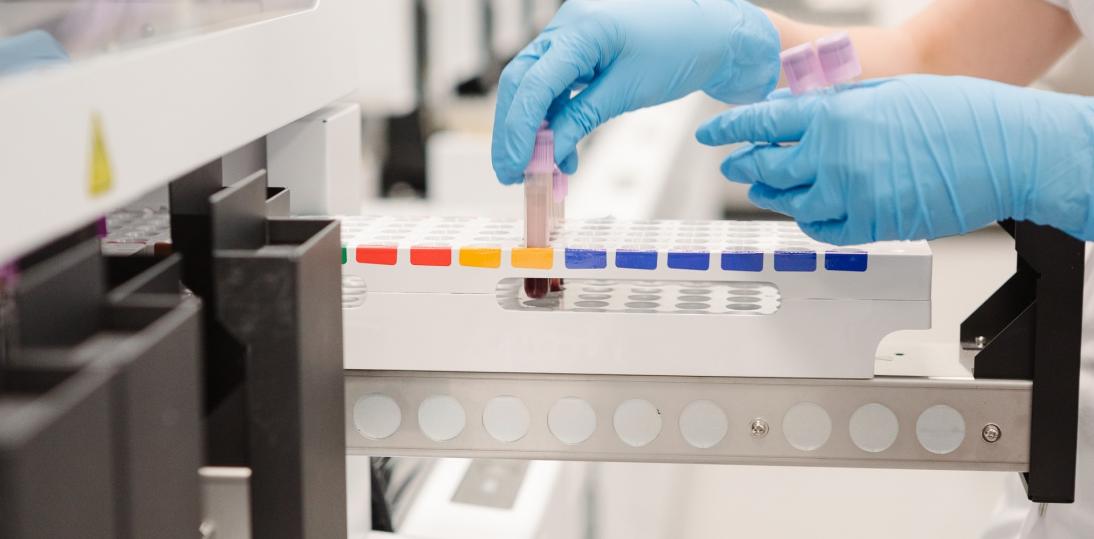 Etap przedanalityczny istotny dla wiarygodności wyników diagnostycznych badań laboratoryjnych