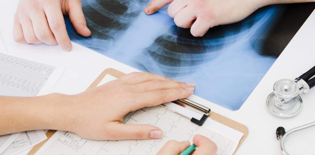 Pacjent z rakiem płuca w dobie epidemii - darmowy webinar 26.05.20