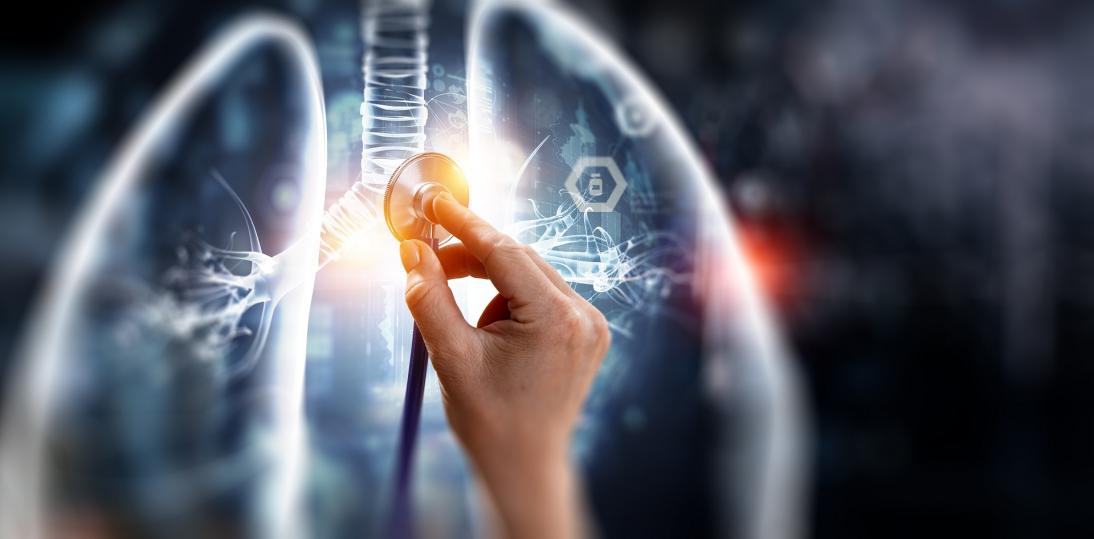 Bez usprawnienia procesu diagnostyki nie będzie sukcesów w leczeniu raka płuca