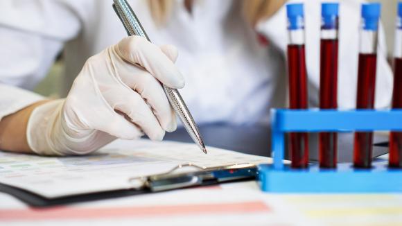 Nakłady na diagnostykę genetyczną to zaledwie 0,5 proc. wydatków na leczenie nowotworów. Potencjał nowoczesnych terapii nie jest w pełni wykorzystywany