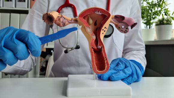 Szpital Medicover: Endometrioza odsłoni swą twarz! Wykonaj test na endometriozę