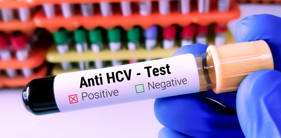 Światowy Dzień WZW. Eksperci dostrzegają wzrost świadomości, ale w walce z HCV pozostaje wiele do zrobienia