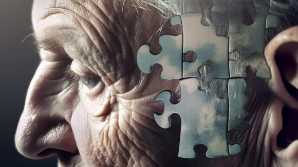 Światowy Dzień Choroby Alzheimera – jak wspierać bliskiego w chorobie otępiennej?