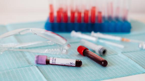 Dni Krwi Pępowinowej i Dni Dawcy Szpiku - PBKM i Fundacja DKMS razem dla wspólnego celu