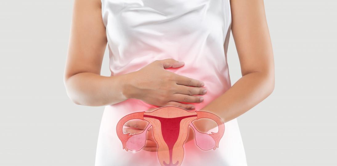 Mięśniaki macicy – może je mieć nawet 70% kobiet, chociaż wcale nie muszą o tym wiedzieć