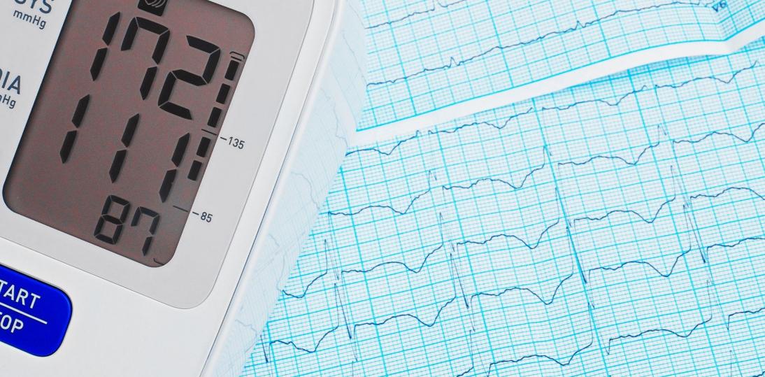 Nadciśnienie tętnicze - cichy zabójca Twojego mózgu i serca. Ta choroba zwiększa ryzyko wystąpienia udaru aż czterokrotnie!