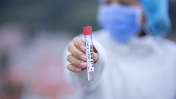 Nowy test na sepsę i COVID-19