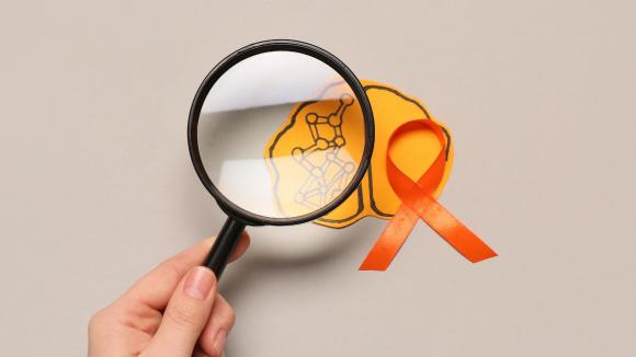 Diagnoza i leczenie osób z SM w Polsce. Perspektywa pacjenta. Czy jesteśmy na światowym poziomie?