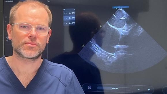 ICE ablation: wyższa wiarygodność anatomii serca to większe bezpieczeństwo ablacji