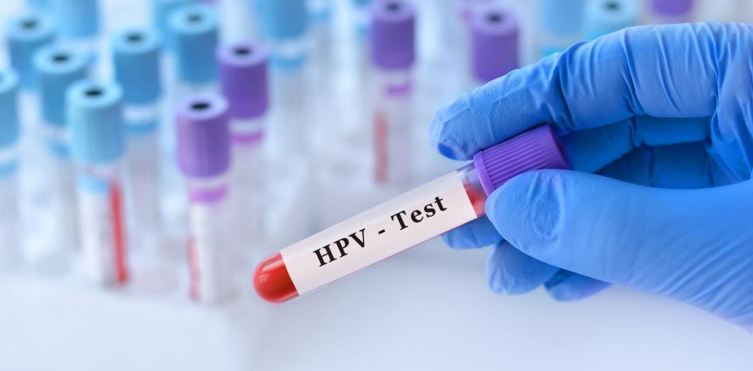 Diagnostyka HPV DNA odmieni wykrywalność raka szyjki macicy w Polsce – kiedy wejdzie do koszyka świadczeń?