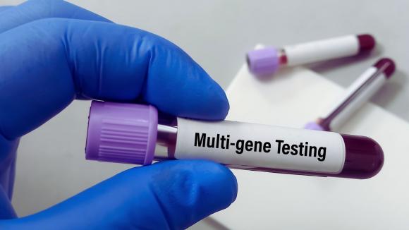 Diagnostyka genetyczna standardem nowoczesnej medycyny – genetyka ratuje życie!