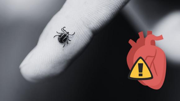 0,3–4% przypadków boreliozy kończy się powikłaniami sercowymi – zagrożenie, o którym mało się mówi