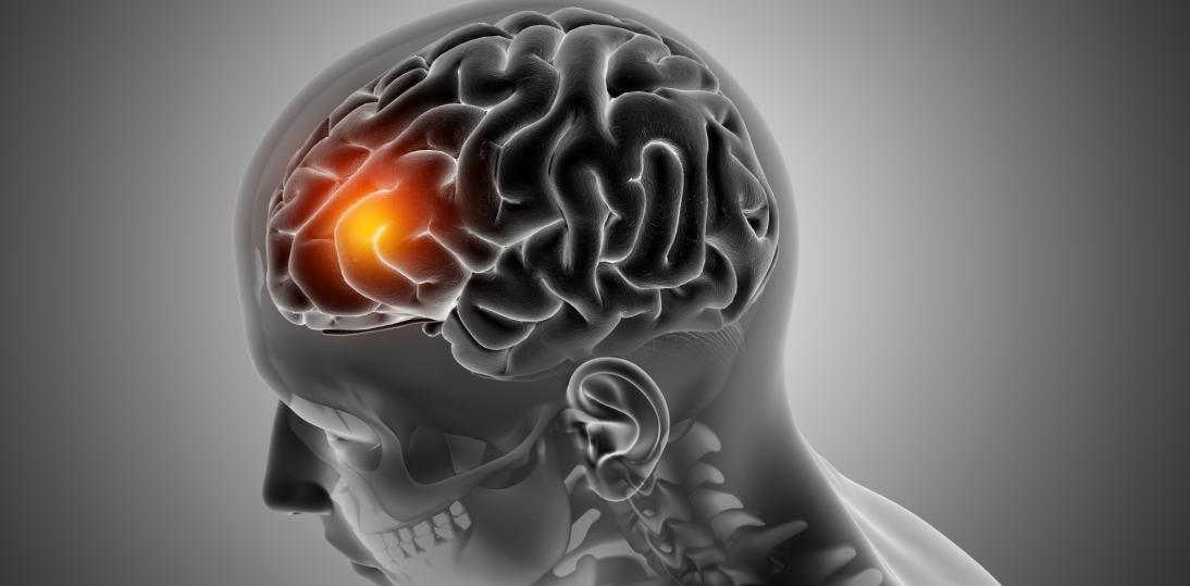 Co ósmy pacjent neurologiczny ma mniej niż 45 lat – system musi zareagować
