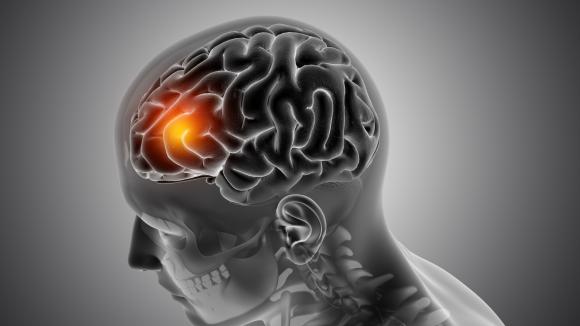 Co ósmy pacjent neurologiczny ma mniej niż 45 lat – system musi zareagować