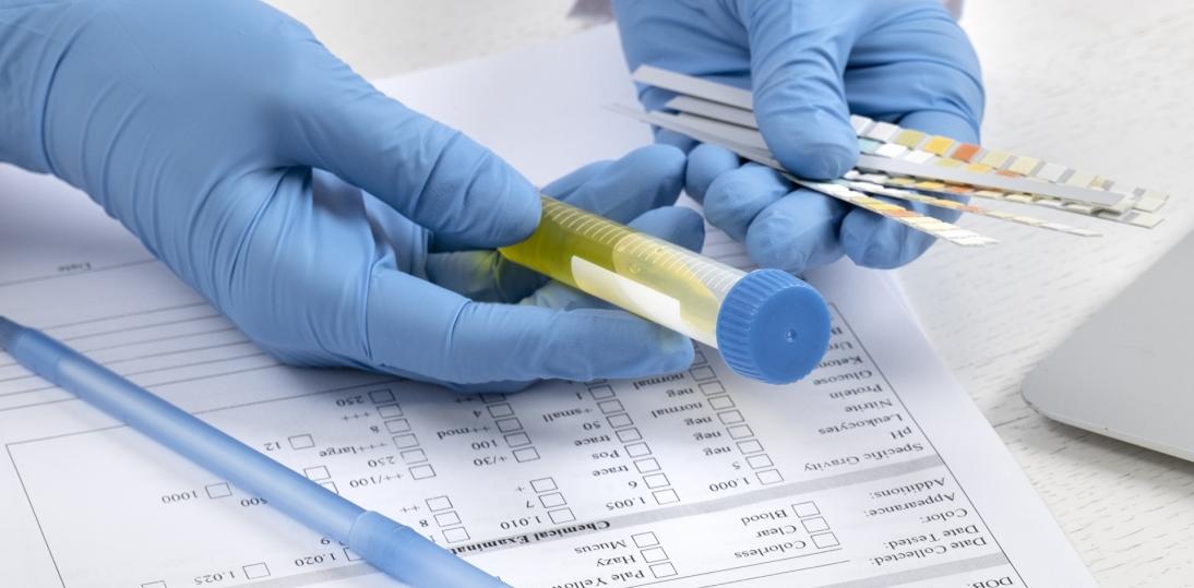 Prosty test moczu może zrewolucjonizować wczesne wykrywanie raka prostaty