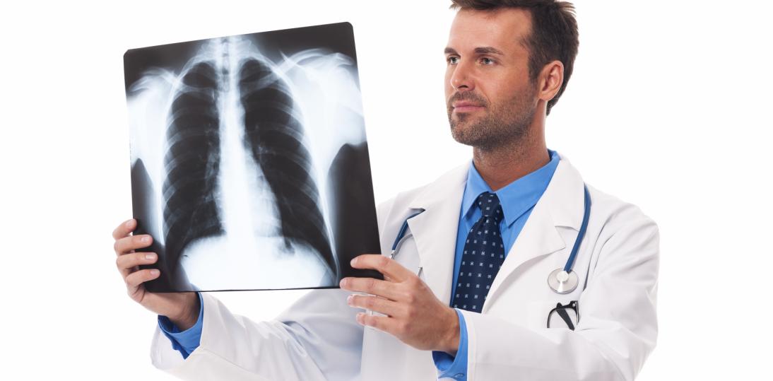 Lung Cancer Unit coraz bliżej refundacji. AOTMiT pozytywnie ocenia kompleksową opiekę nad pacjentami z rakiem płuca