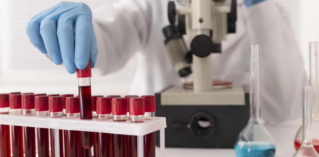 World Blood Cancer Day: Co 40 minut diagnoza nowotworu krwi. Choroby krwi wciąż zbyt mało znane