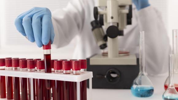World Blood Cancer Day: Co 40 minut diagnoza nowotworu krwi. Choroby krwi wciąż zbyt mało znane