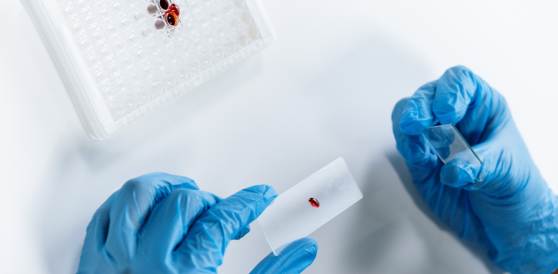 Nowoczesne terapie w hematologii zmieniają standard leczenia. Eksperci: liczy się nie tylko skuteczność, ale też bezpieczeństwo