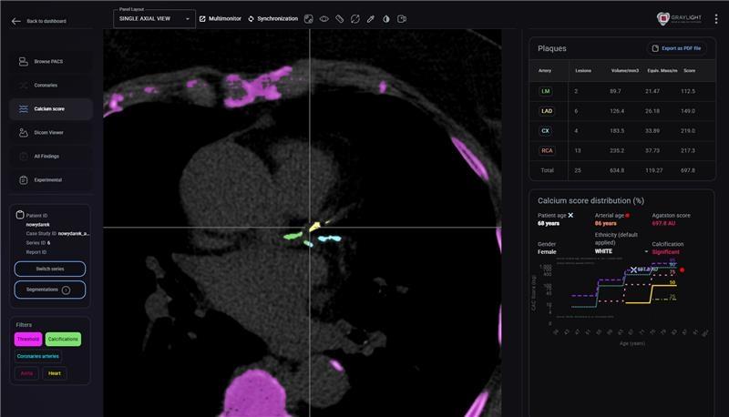 BRIGHTER – polska platforma radiologiczna, która przesyła dane diagnostyczne tak sprawnie, jak serwisy streamingujące seriale