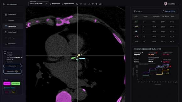 BRIGHTER – polska platforma radiologiczna, która przesyła dane diagnostyczne tak sprawnie, jak serwisy streamingujące seriale