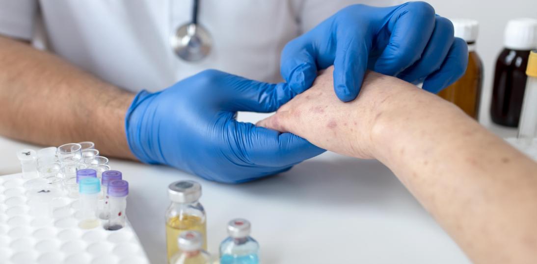 Wszystko, co warto wiedzieć o ranach przewlekłych – przyczyny, diagnoza, leczenie