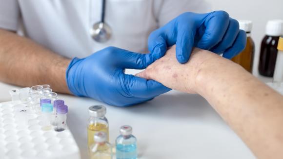Wszystko, co warto wiedzieć o ranach przewlekłych – przyczyny, diagnoza, leczenie