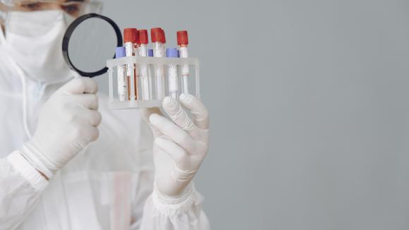 Bio-Rad wprowadził w Polsce testy w kierunku COVID-19