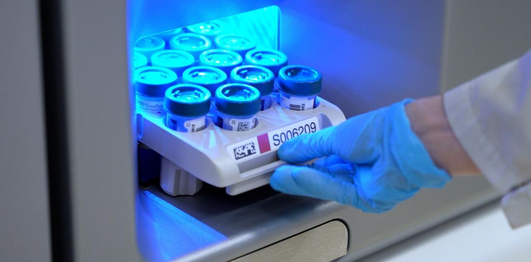 Nowa technologia w profilaktyce raka szyjki macicy: ALAB laboratoria wdraża aparaturę nowej generacji, wykorzystującą rozszerzone genotypowanie do badań wirusa HPV