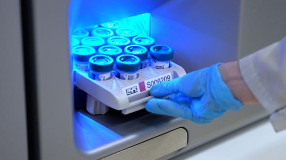 Nowa technologia w profilaktyce raka szyjki macicy: ALAB laboratoria wdraża aparaturę nowej generacji, wykorzystującą rozszerzone genotypowanie do badań wirusa HPV