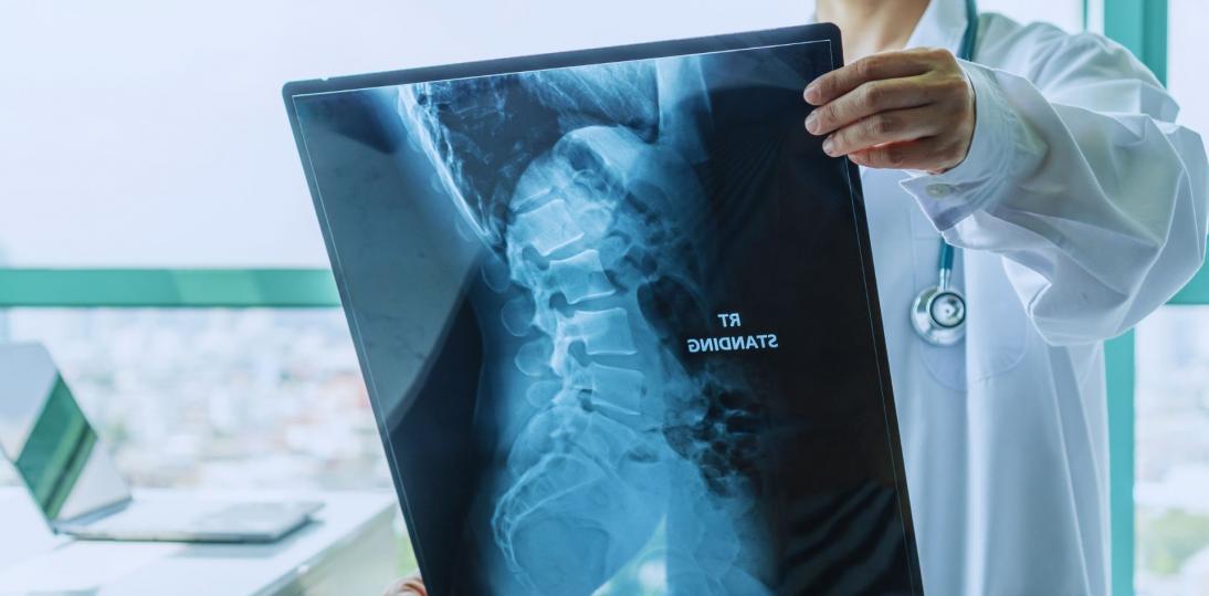 Nowa forma leczenia SMA ułatwi życie pacjentom i odciąży system ochrony zdrowia