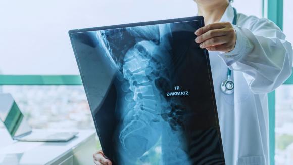 Nowa forma leczenia SMA ułatwi życie pacjentom i odciąży system ochrony zdrowia