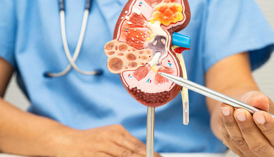 Pierwotna hiperoksaluria – rzadka choroba, która niszczy nie tylko nerki. Dziś jest możliwa do leczenia