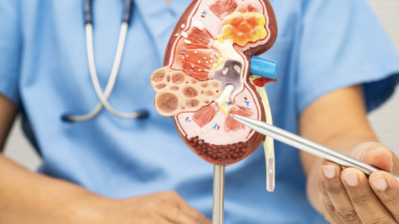 Pierwotna hiperoksaluria: wyzwania diagnostyczne i konieczne zmiany systemowe